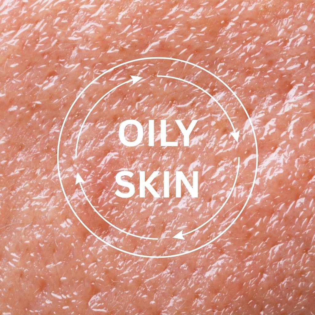 OILY SKIN