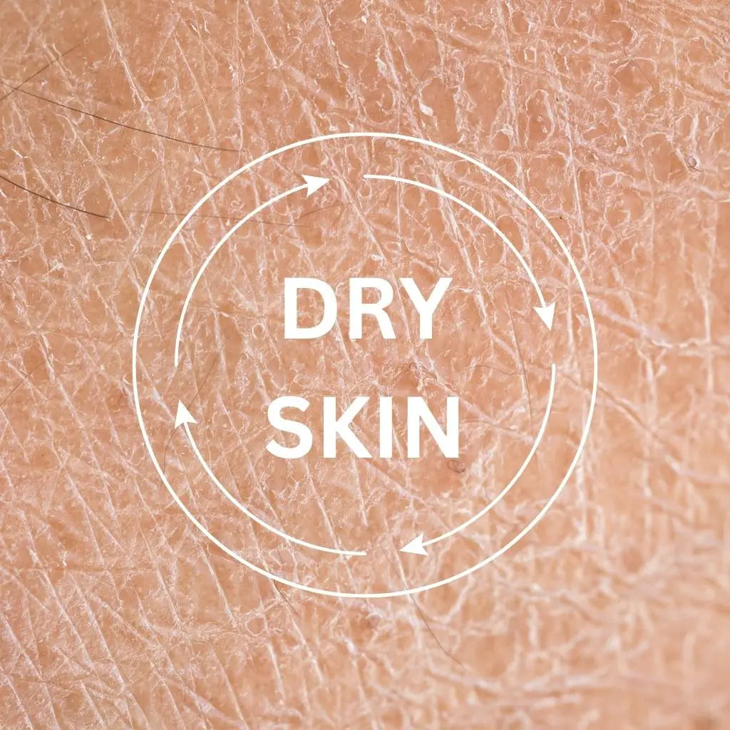 DRY-SKIN arganabeauty.ae