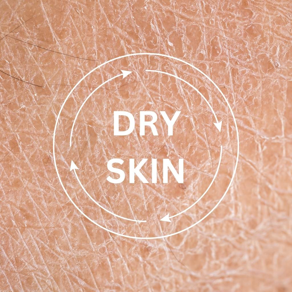 DRY SKIN