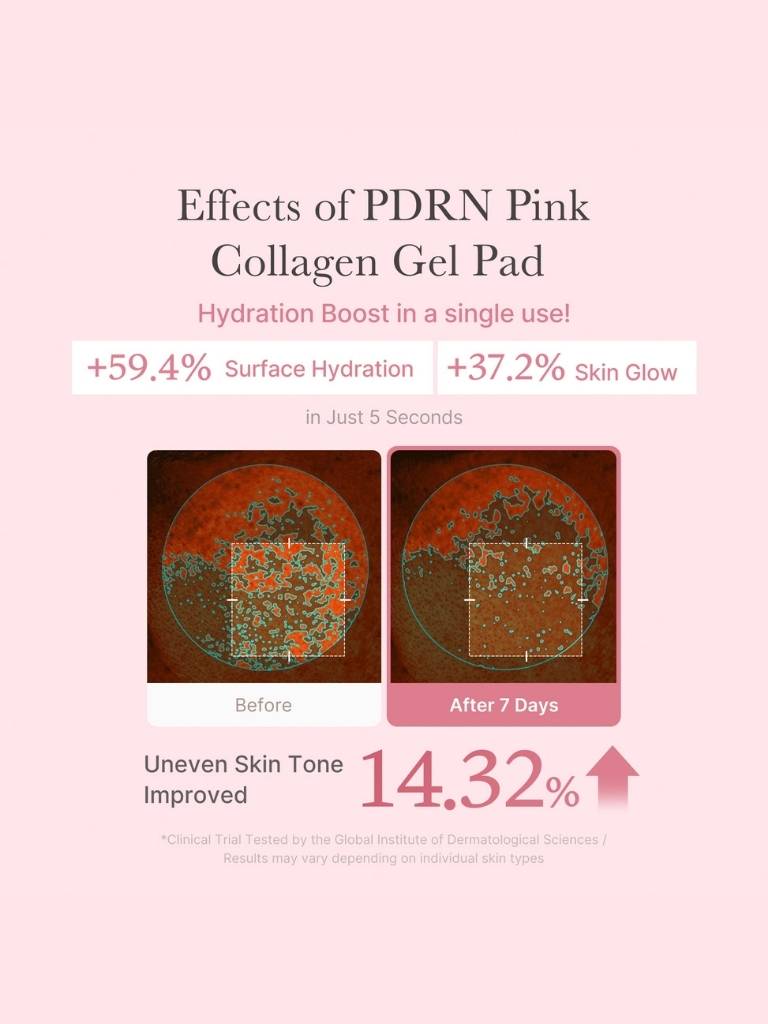Advertisement for PDRN Pink Collagen Gel Pad showing hydration and skin tone improvement before and after use.