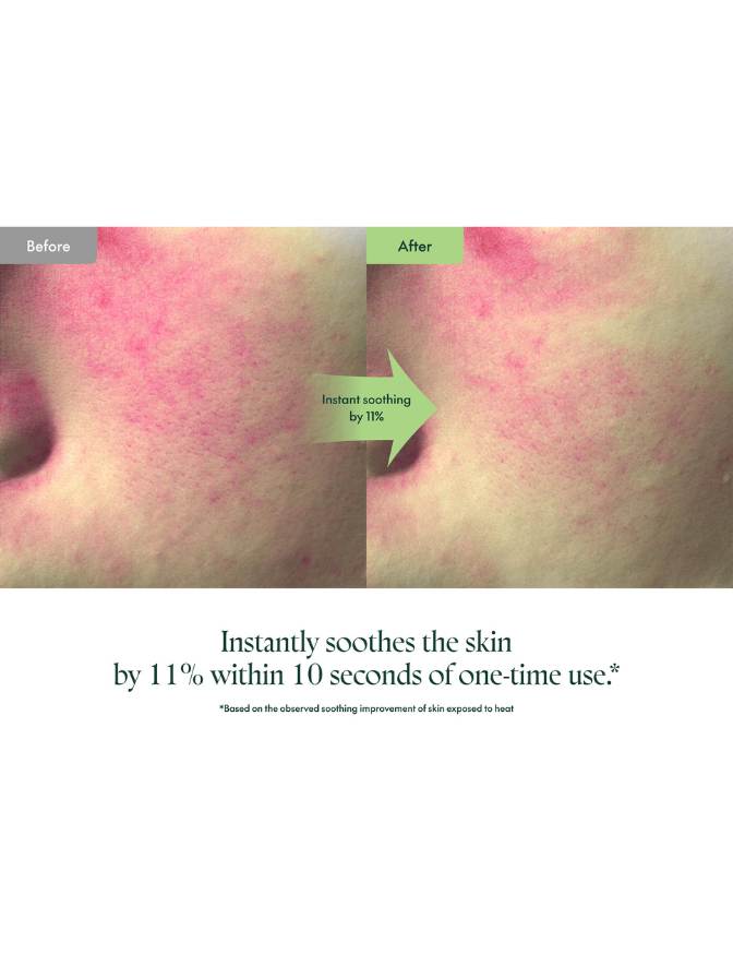 Before and after comparison of skin with a green arrow indicating instant soothing effect.