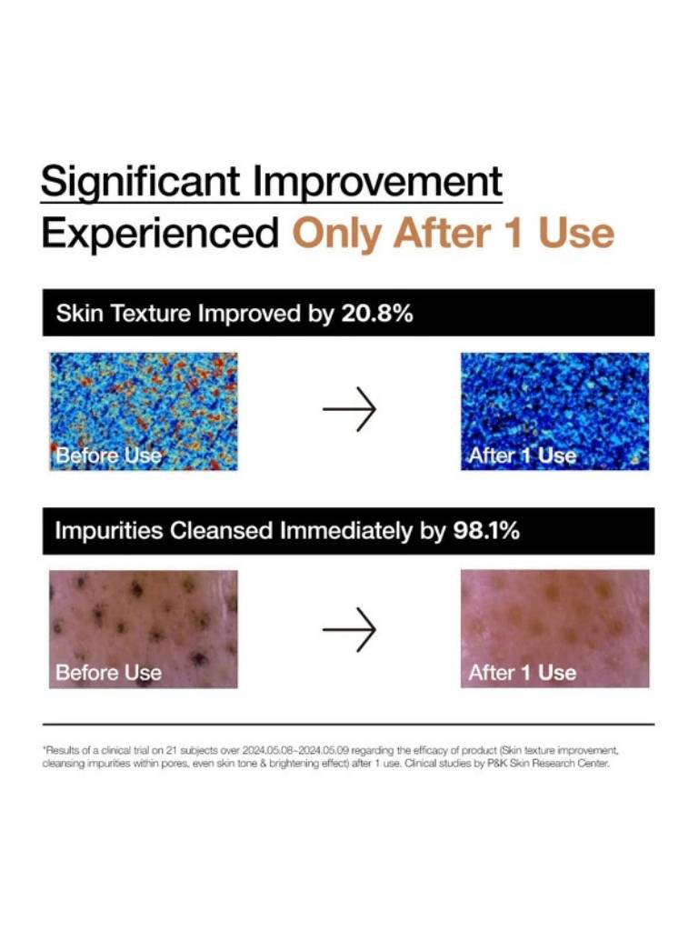 Advertisement showing skin texture improvement and impurity reduction after a single use of a product.