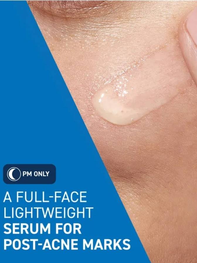 Close-up of skin with a serum droplet and text about a full-face lightweight serum for post-acne marks.
