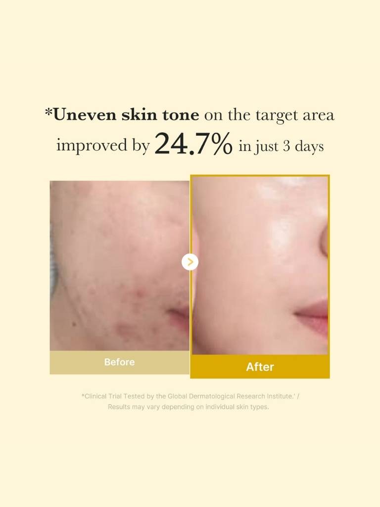 Before and after comparison of uneven skin tone improvement on a target area with text indicating a 24.7% improvement in just 3 days.
