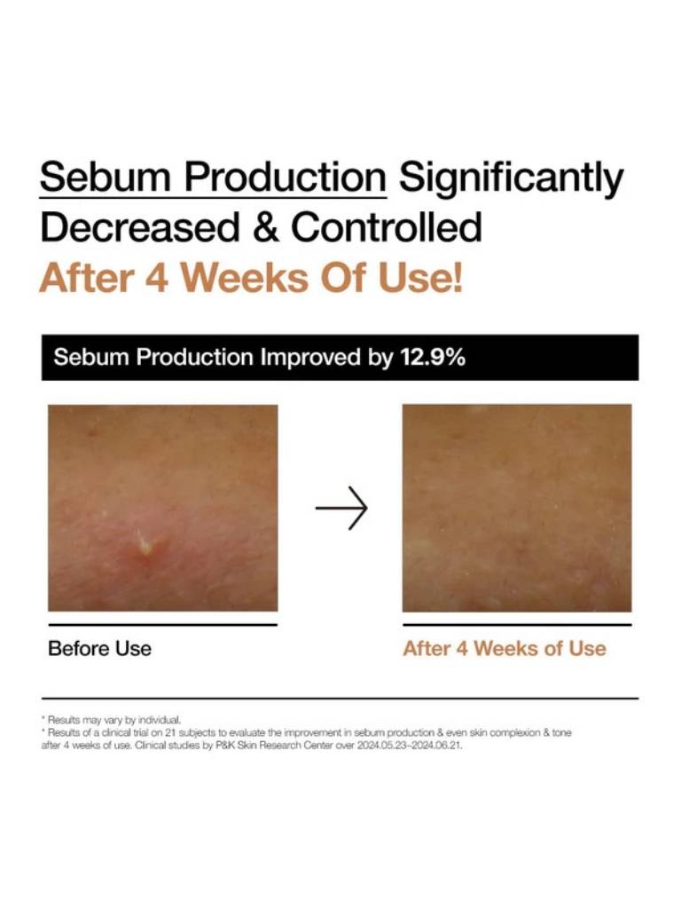 Advertisement showing a before and after comparison of sebum production improvement on skin.
