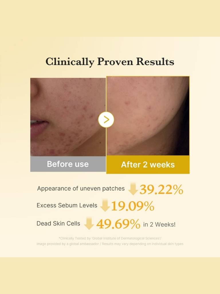 Before and after comparison of skin treatment with clinical results on a beige background