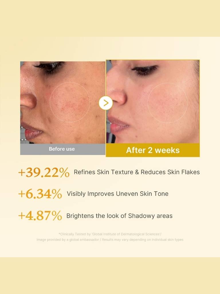 Before and after skin texture comparison with text on a beige background
