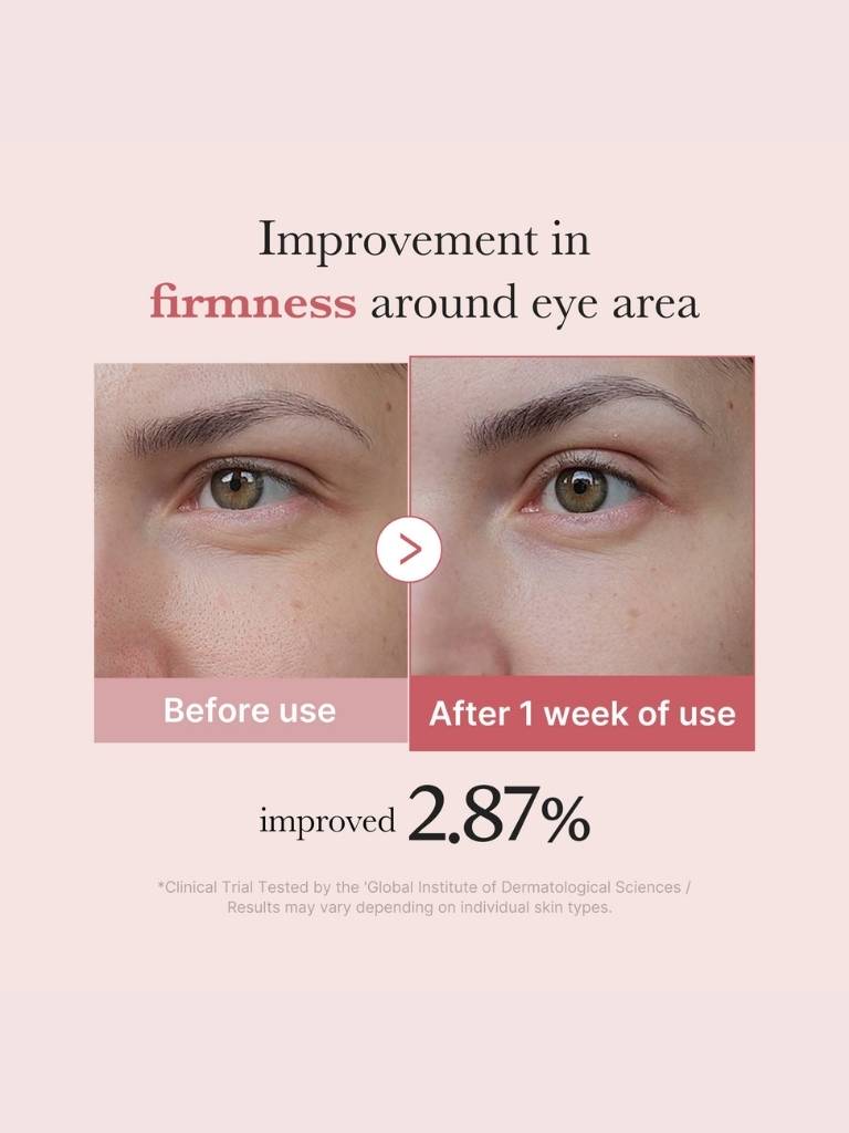 Before and after comparison of eye area firmness improvement with text on a beige background