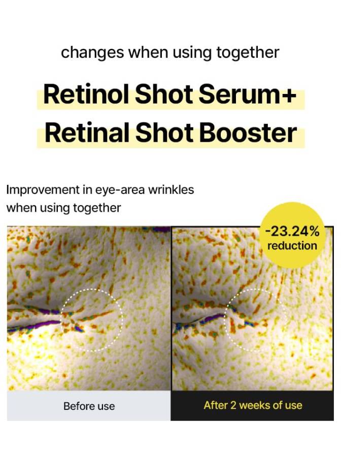 Advertisement for Retinol Shot Serum and Booster showing before and after effects on eye-area wrinkles.