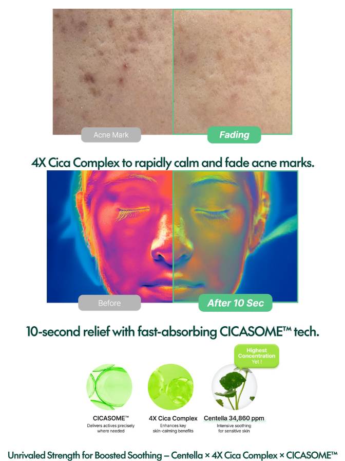 Advertisement for a skincare product showing before and after effects on acne marks.