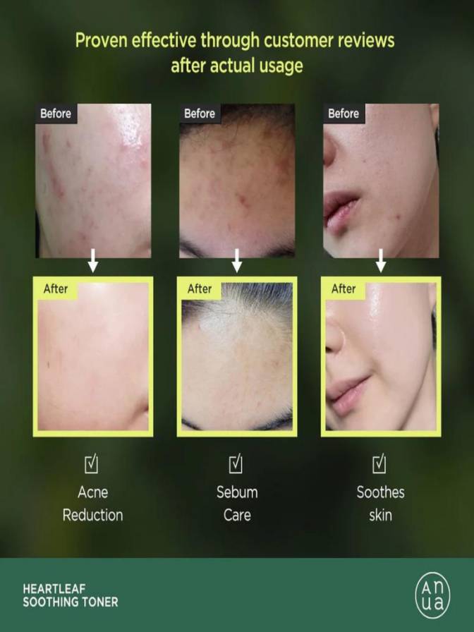 Before and after effects of a skincare product on skin with visible improvements.