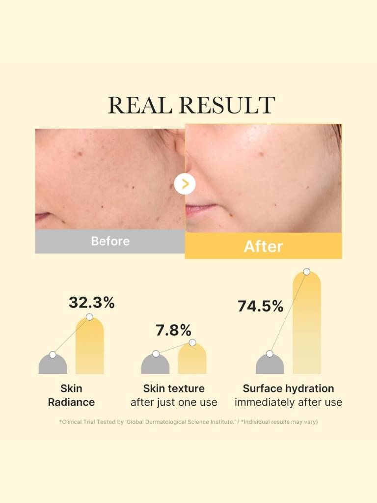 Before and after comparison of skin improvement with percentages shown.
