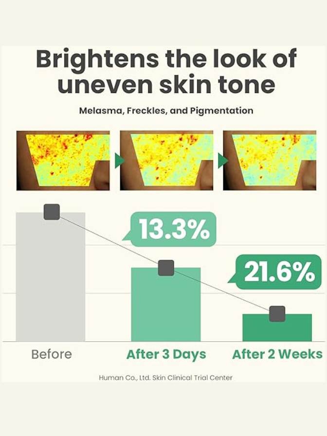 Before and after effect of a skincare product on skin tone, showing a decrease in melasma, freckles, and pigmentation.