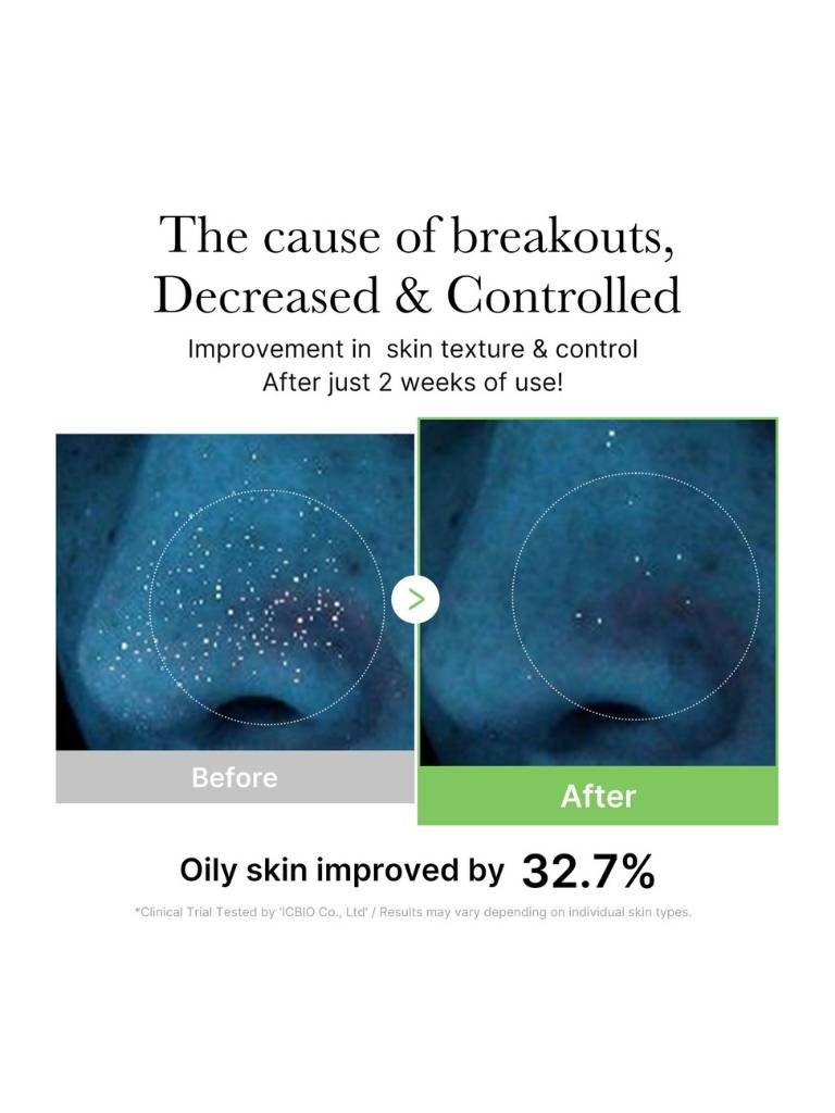 Before and after comparison of oily skin improvement with text on a white background