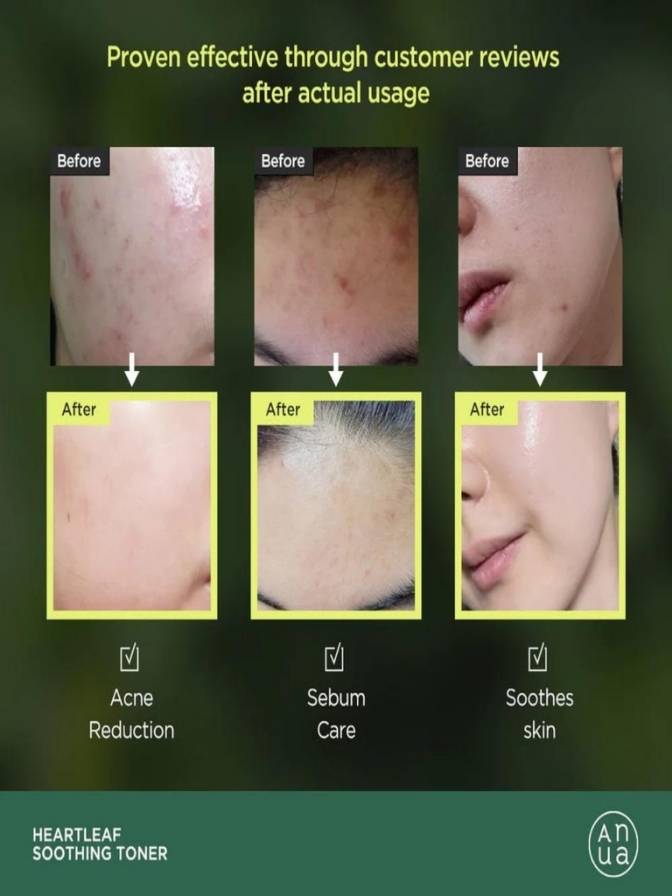 Before and after effects of a skincare product on skin with visible improvements.