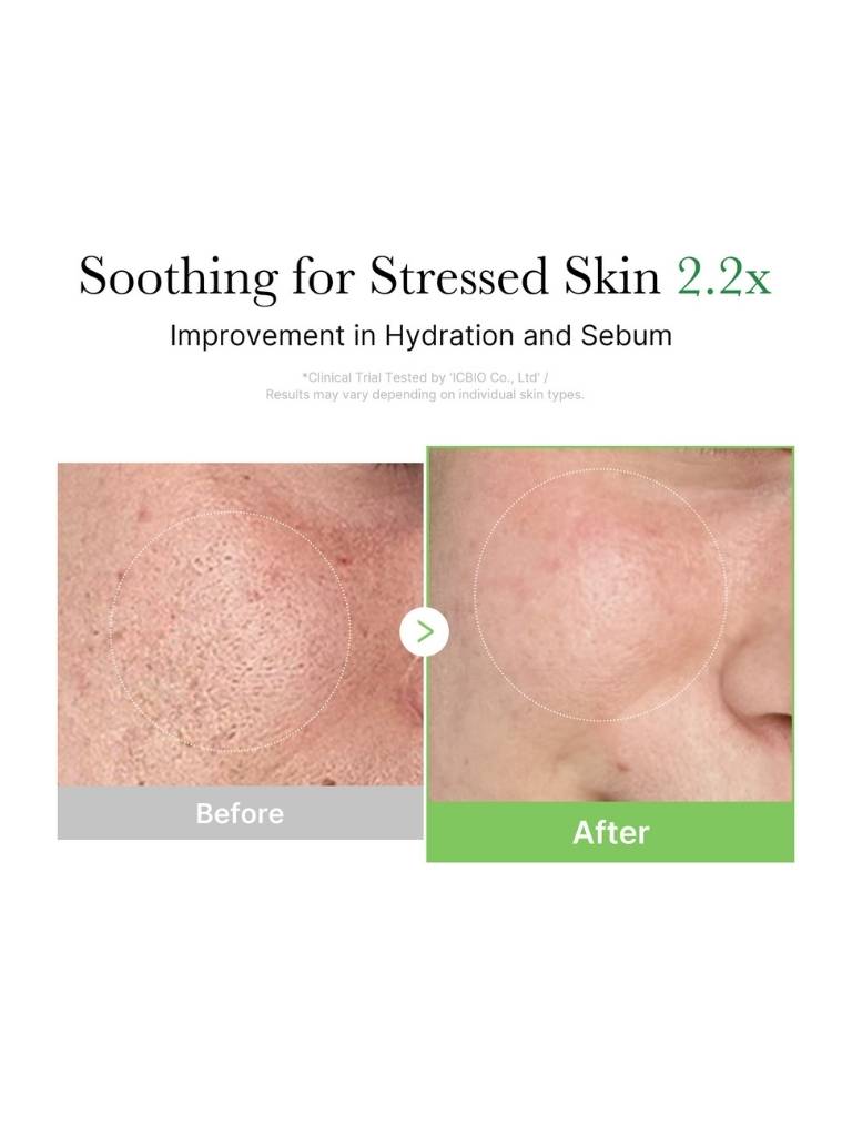 Before and after comparison of stressed skin with text indicating improvement in hydration and sebum.