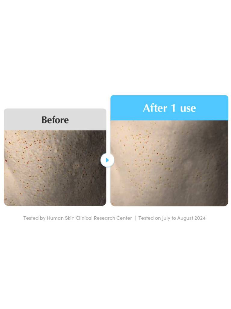 Before and after skin treatment comparison with 'Before' showing blemishes and 'After 1 use' showing improved skin texture.