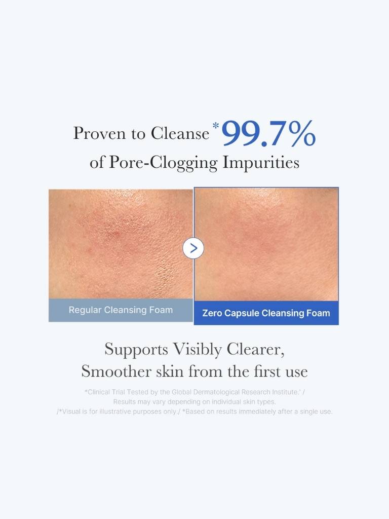 Comparison of skin before and after using zero capsule cleansing foam with text highlighting effectiveness.