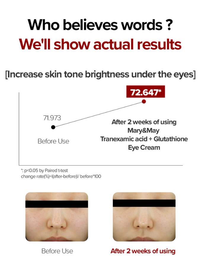 Advertisement for Mary&May eye cream showing before and after effects on skin tone brightness.