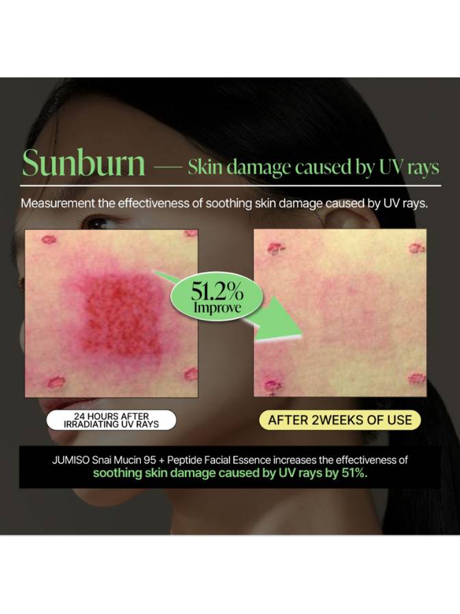 Advertisement showing before and after effects of UV rays on skin with JUMISO Snail Mucin 95 + Peptide Facial Essence.