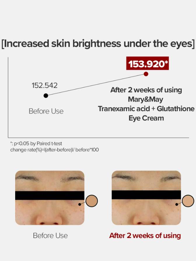 Before and after comparison of skin brightness under the eyes using Mary&May eye cream.