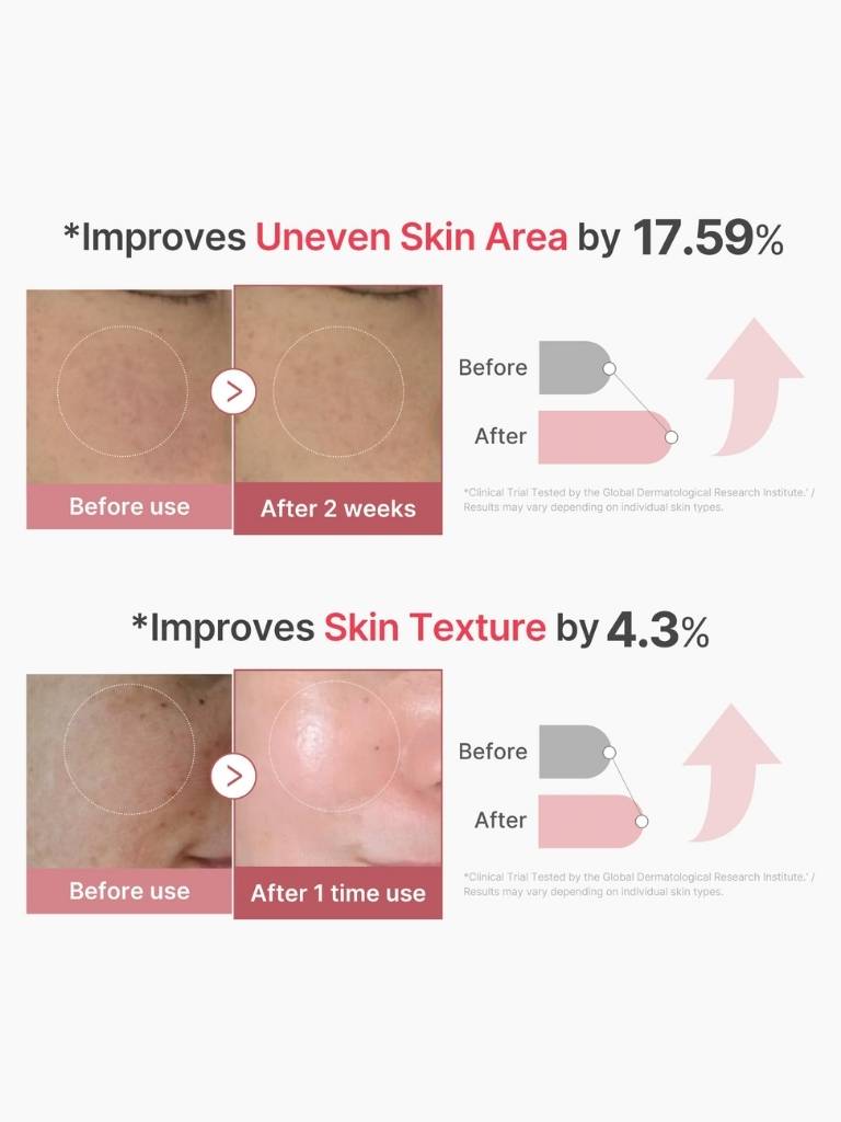 Before and after skin improvement results with text indicating percentage improvements.