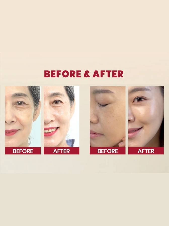 Before and after comparison of a woman's face on a beige background
