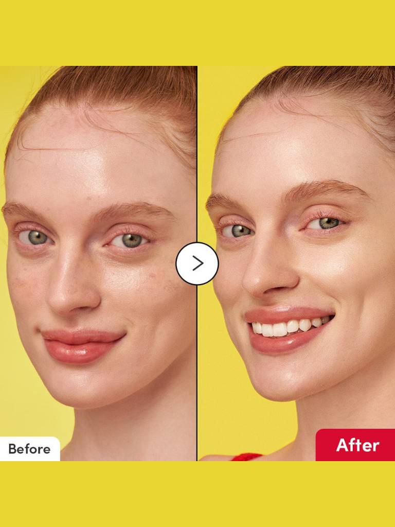 Before and after comparison of a woman's face with a yellow background