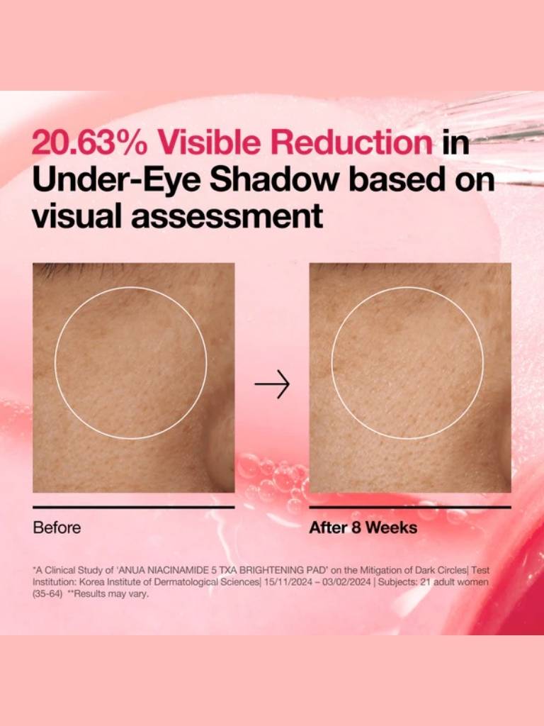 Before and after comparison of under-eye shadow reduction with text on a pink background