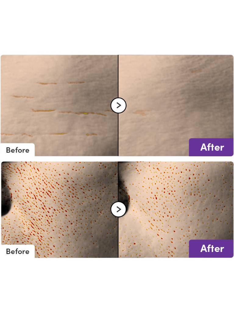 Before and after comparison of skin treatment on a white background