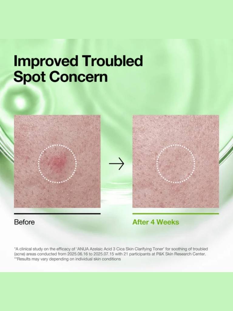 Before and after comparison of troubled spot treatment with a green background