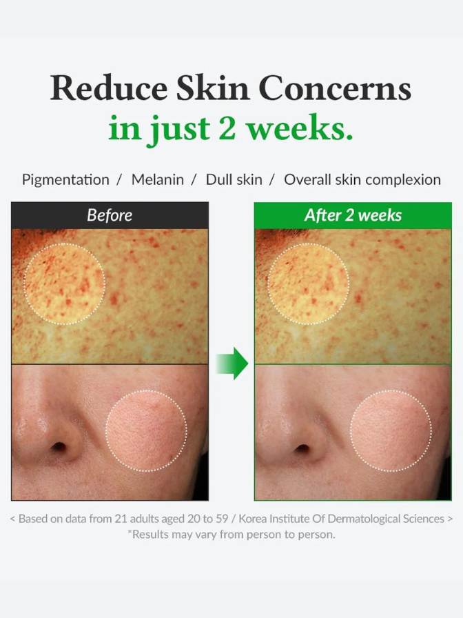 Before and after comparison of skin concerns with text indicating results in just 2 weeks.
