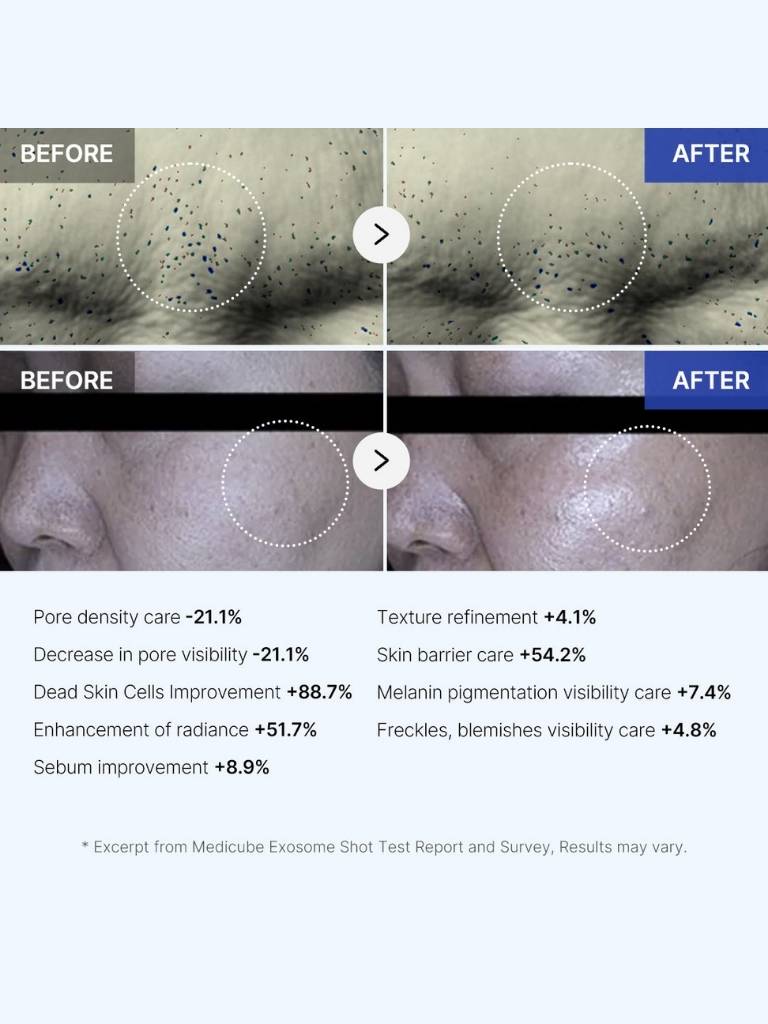 Before and after skin treatment comparison with text indicating improvement metrics.
