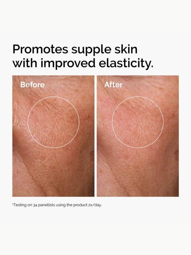 Before and after comparison of skin texture with text promoting suppleness and elasticity.