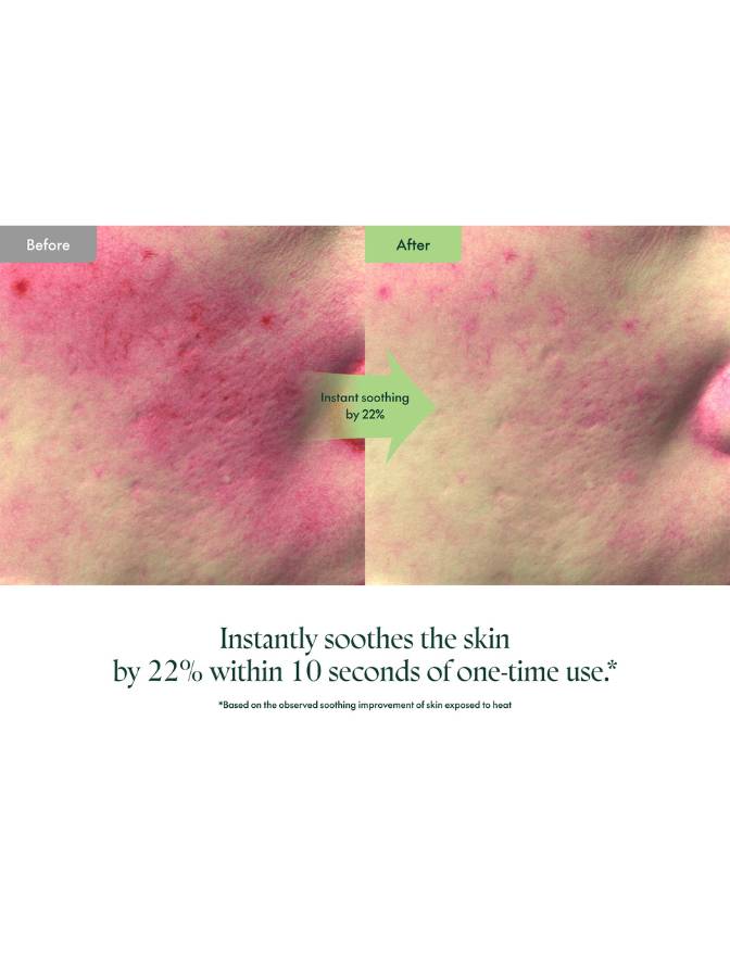 Before and after comparison of skin with redness, showing a 22% instant soothing effect.
