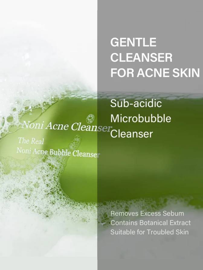 Product packaging for a gentle cleanser for acne skin with green and white design.