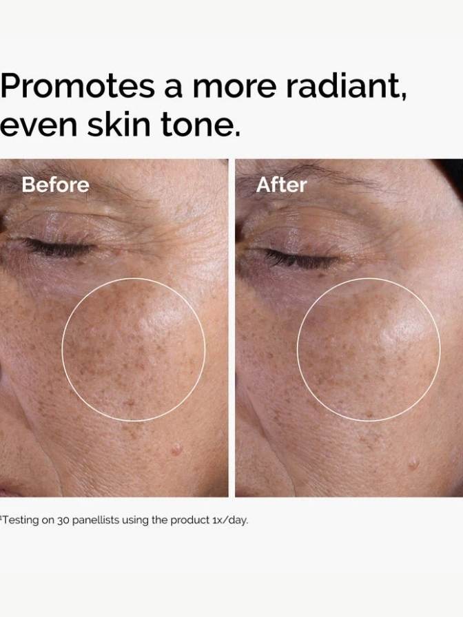 Before and after comparison of skin with a focus on promoting a more radiant, even skin tone.