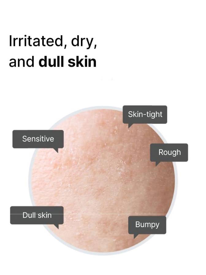 Illustration of skin with various issues labeled on a white background