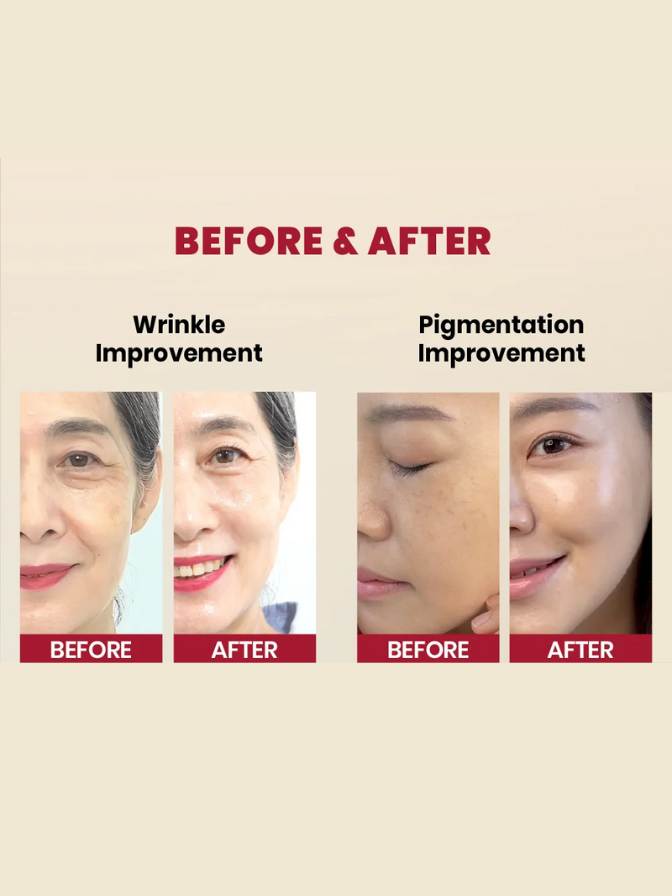 Before and after comparison of wrinkle and pigmentation improvement on a beige background.