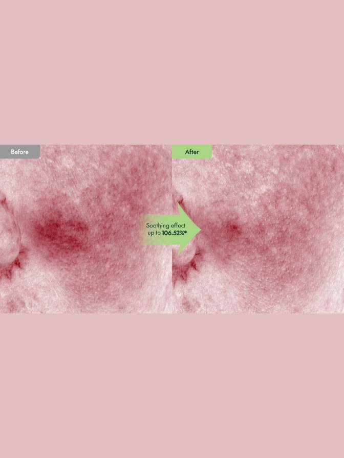 Before and after comparison of skin texture on a pink background