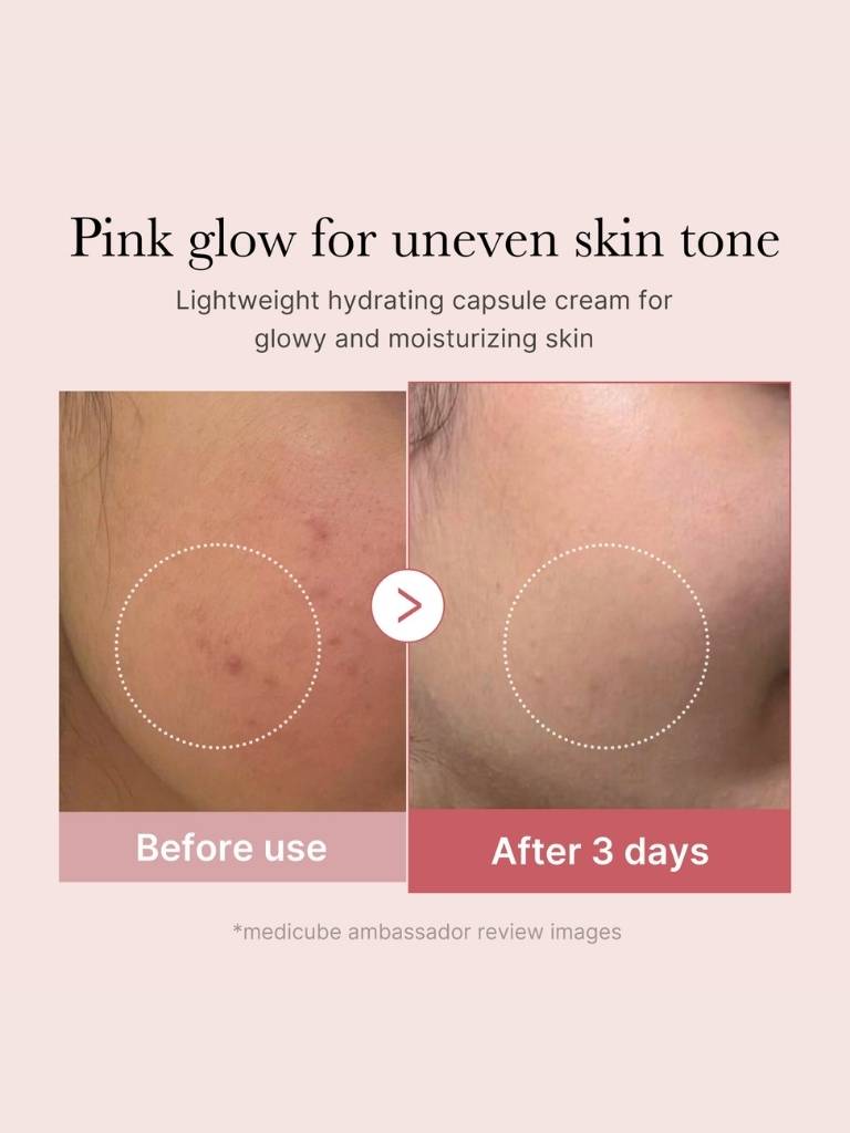 Before and after comparison of skin tone improvement with a hydrating cream, showing a pink glow for uneven skin tone.