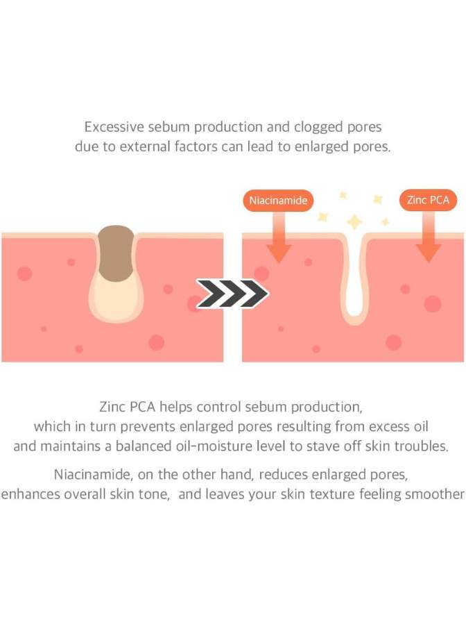 Illustration of skin with enlarged pores, showing the effects of Zinc PCA and Niacinamide on sebum production and pore size.