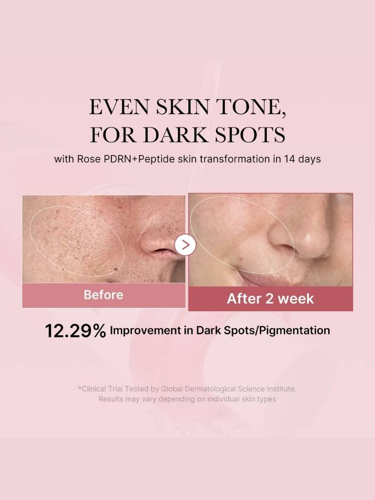 Before and after skin tone improvement with Rose PDRN+Peptide on a pink background