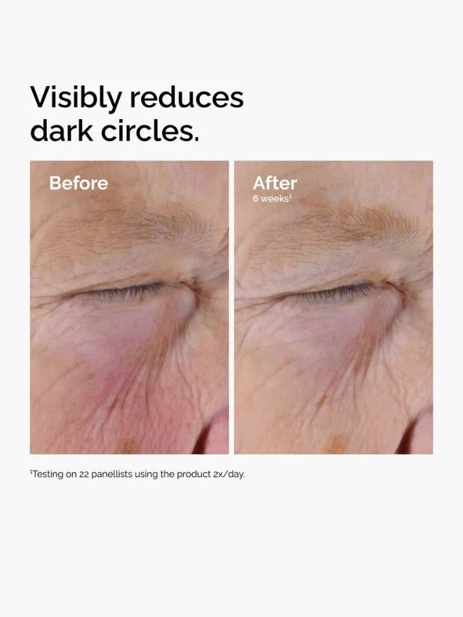 Before and after comparison of dark circles under eyes with text indicating reduction.