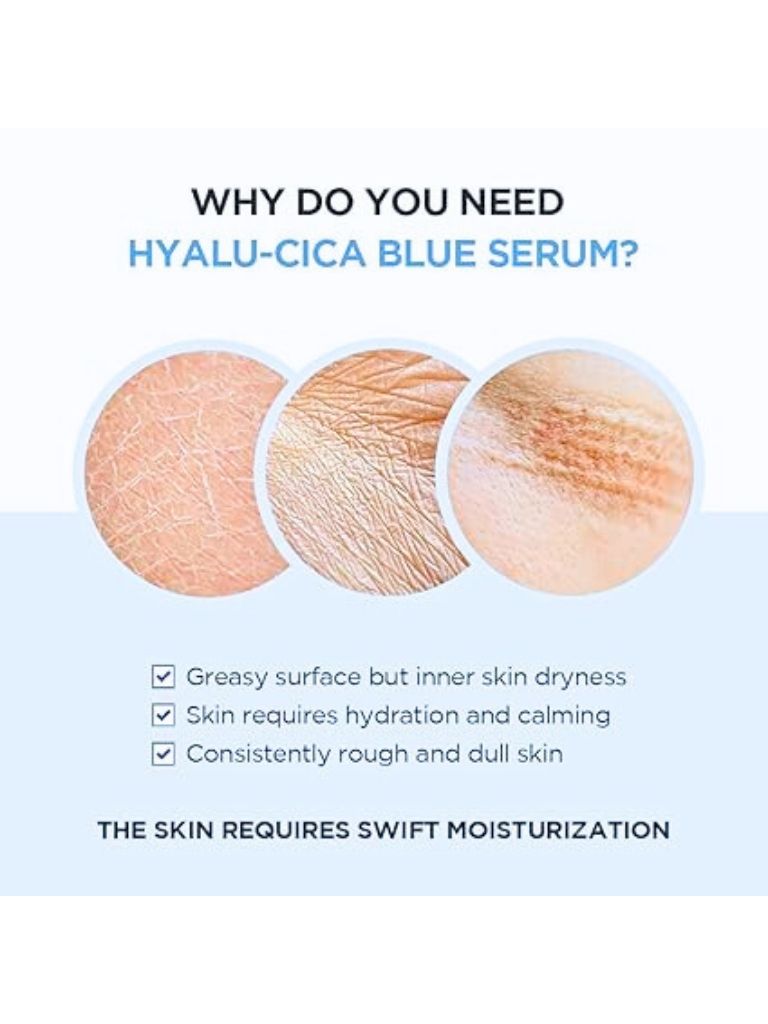 Hyalu-Cica Blue Serum – 5-Layer Hyaluronic Acid, Cica 50Ml